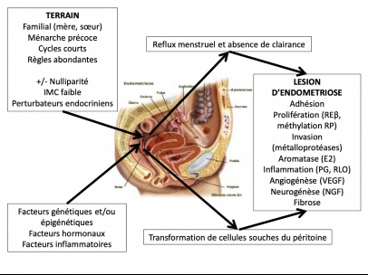 Legende Lesion Endometriose Pm