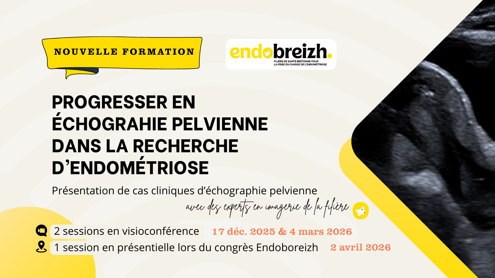 Nouvelle Formation Progresser En écho Pelvienne Endobreizh V2